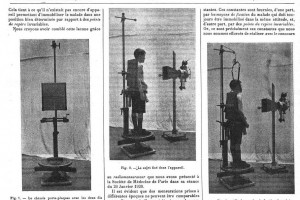 Radiografia ©LA PRESSE MÉDICALE:1921| Bibliothèque Interuniversitaire de Santé (Paris)