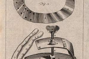 Instrumentos cirúrgicos: torniquetes. Gravura por T. Jefferys, 1771 ©Wellcome Collection