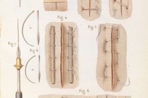 Várias técnicas de sutura e instrumentos ©Wellcome Collection
